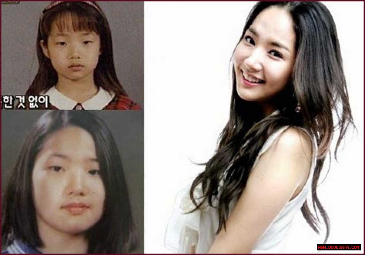 Park Min Young's Transformation: Uncovering The Journey Before Surgery