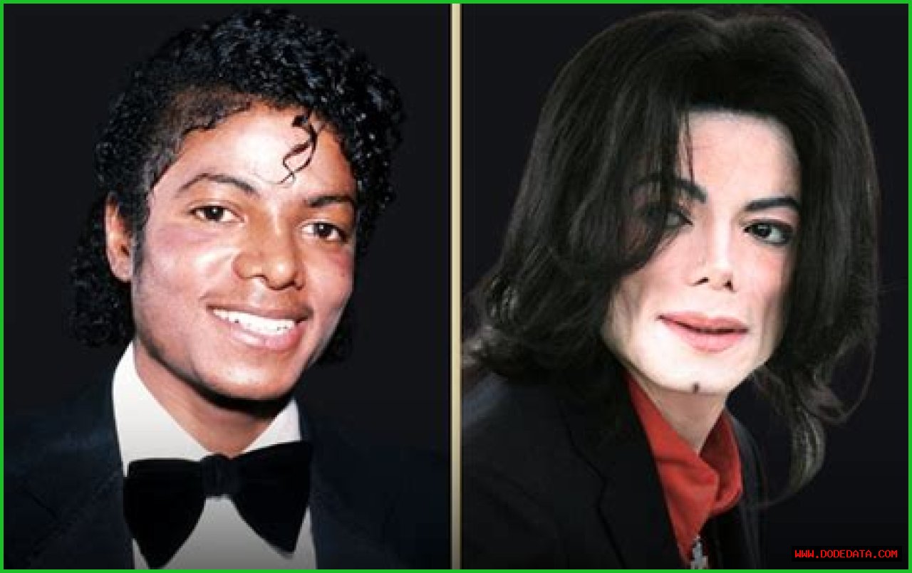 Transformations Of A Legend: Michael Jackson Before And After