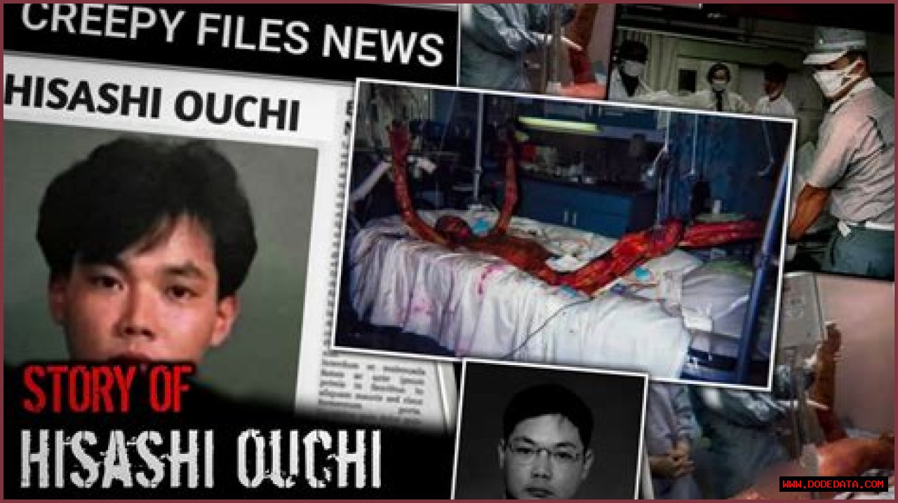 Unveiling The Mystery: The Enigma Of Hisashi Ouchi's Real Photo Body