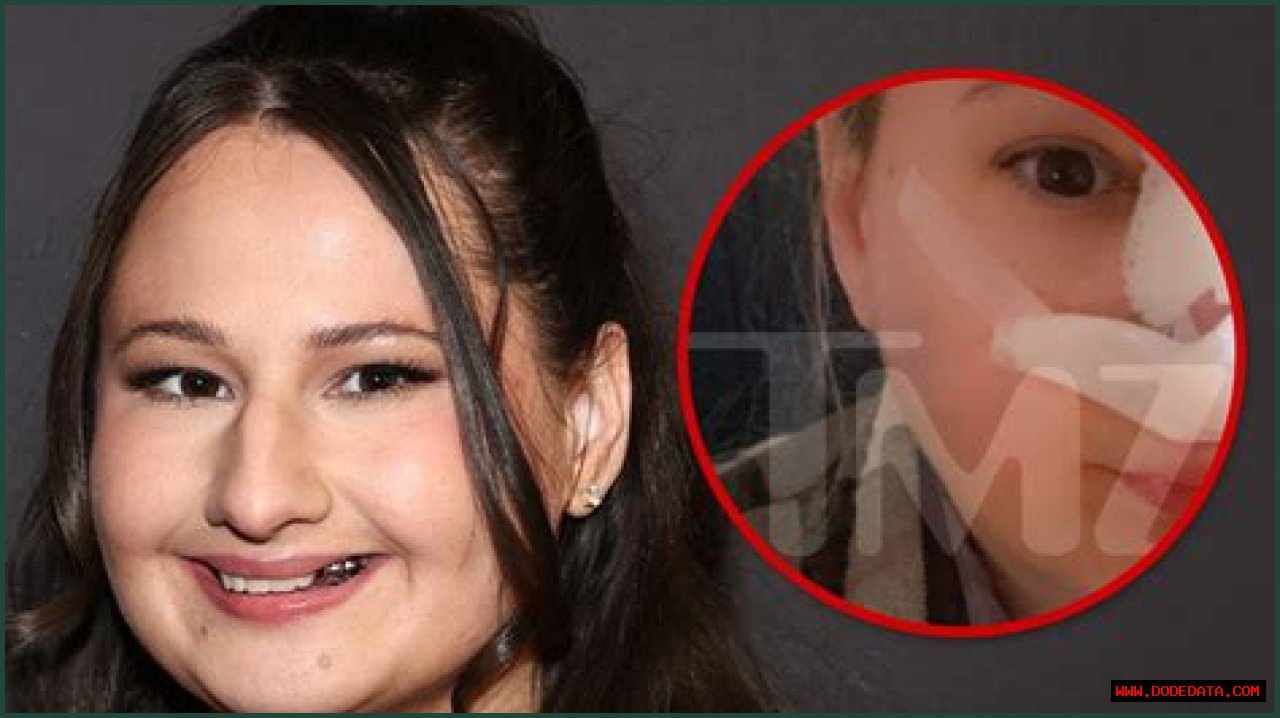 Unveiling The Transformation: The Nose Job Of Gypsy Rose