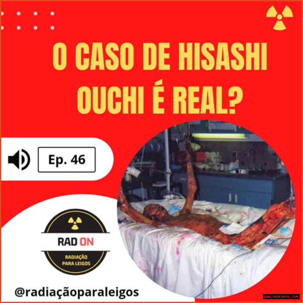 Unveiling The Truth Behind Hisashi Ouchi's Real Photo