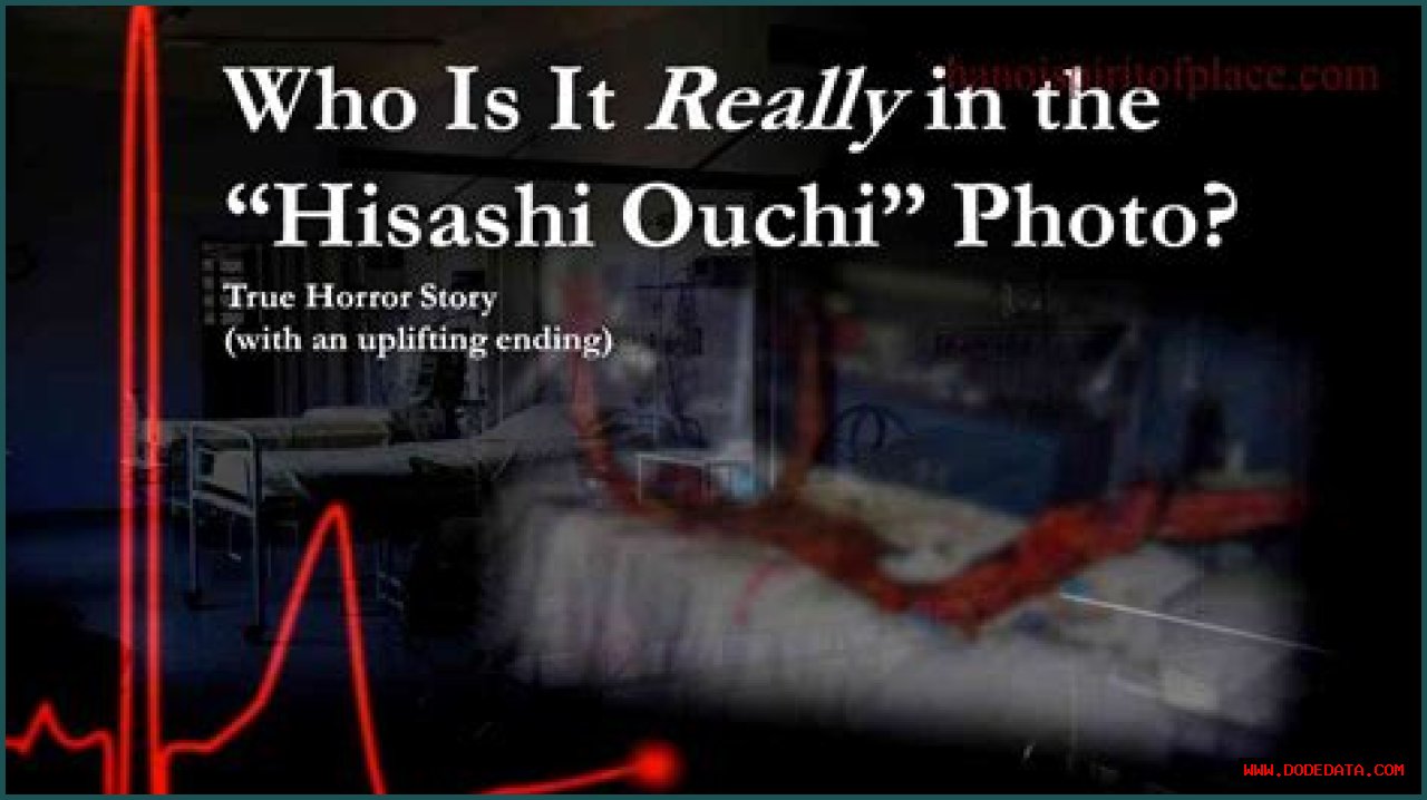Unveiling The Truth: Hisashi Ouchi's Real Photos From The Hospital